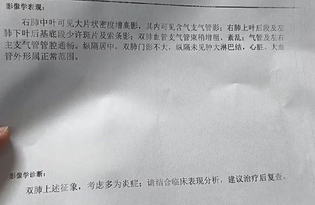 反复发烧39℃+,烧成白肺,西南医大中医院杜渊一剂中药退烧(图4) 4.jpg