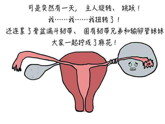 17岁女孩腹痛呕吐,卵巢扭了540度成“麻花”(图1) 1.jpg