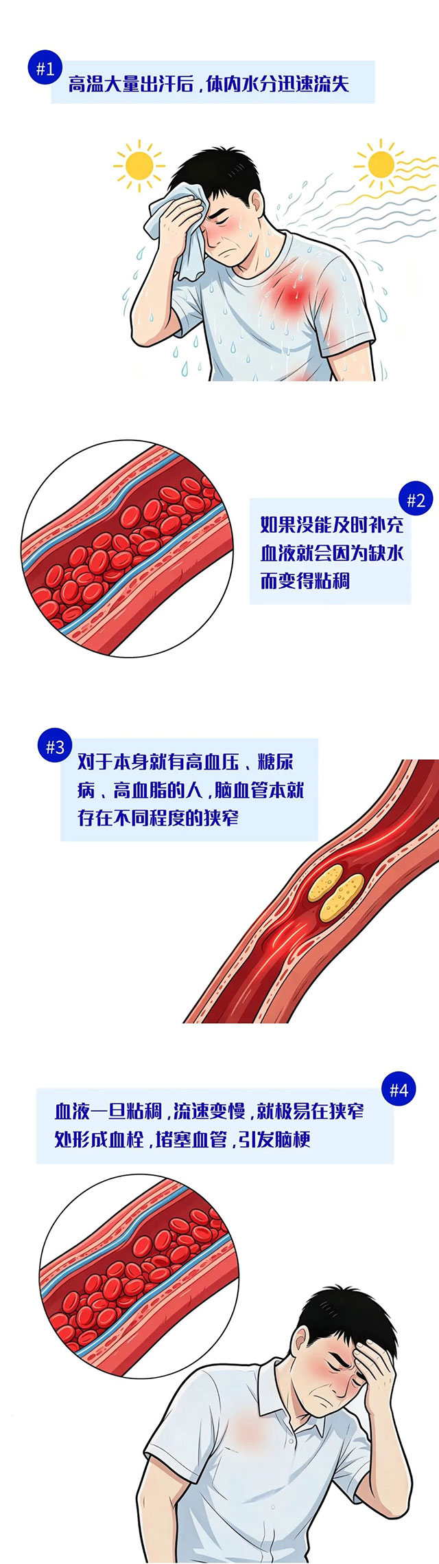 泸州的高温天又放倒一个!不爱喝水的老王遭了脑梗(图4) 4.jpg