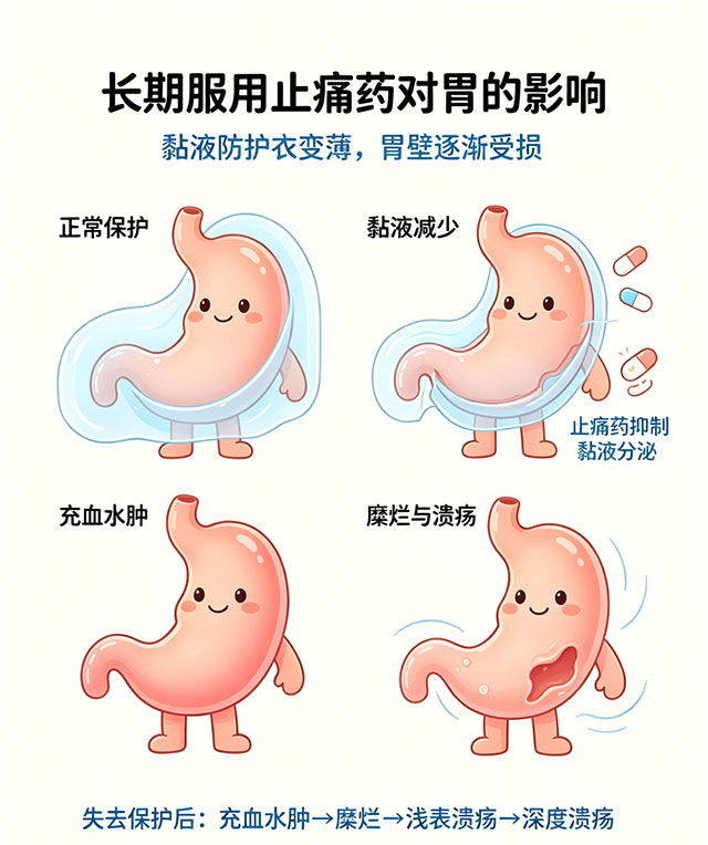 别再乱吃止痛药了!75岁老人呕血休克,胃出血险丧命(图6) 6.jpg