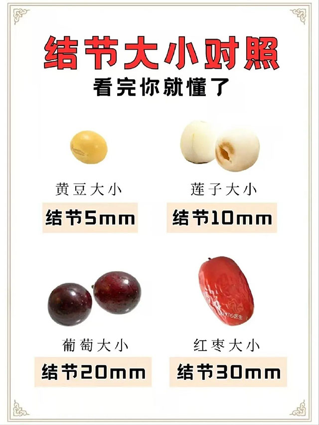 【科普】有肺结节?别慌!90%都是来“摸鱼”的→(图5) 5.jpg