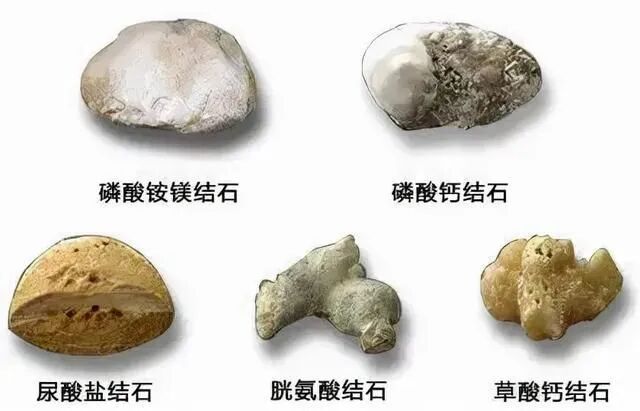 大学生减肥时突发绞痛,紧急入院救治!这些情况要注意……(图4) 肥4.jpg