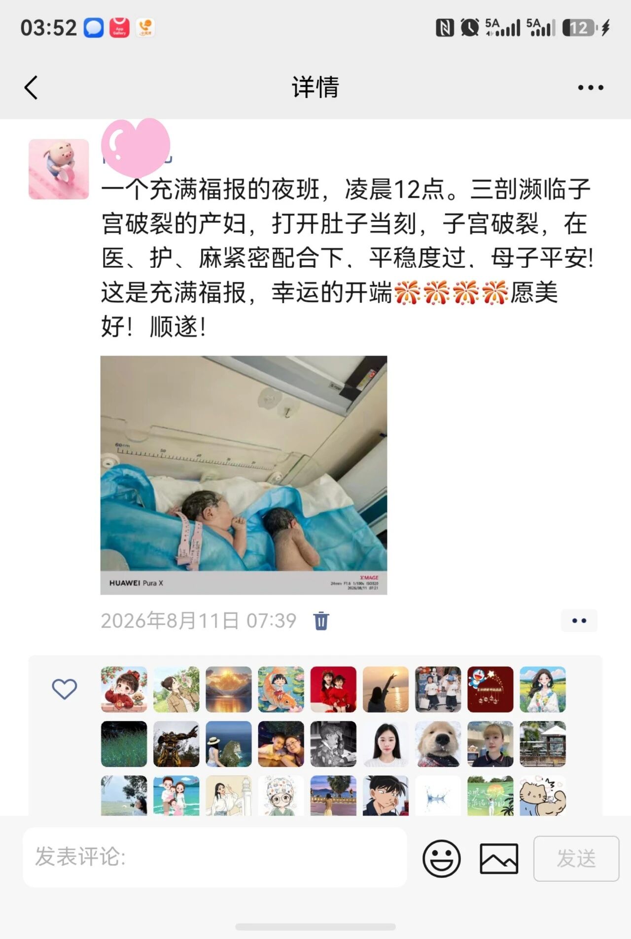 还没下刀,子宫里突然伸出一只小手!(图2) 开刀2.jpg