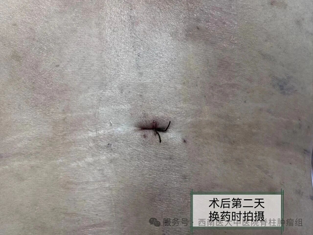 泸州医生痛得躺在高铁过道上!含泪提醒!(图5) 痛5.jpg