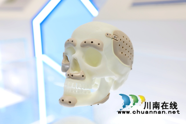 龙马潭:向新提质 三大维度构建产业发展新格局(图2) 02四川图灵智放医疗技术有限公司头骨修补模型.jpg