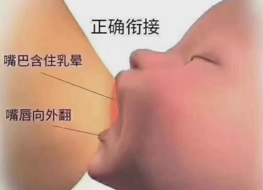 哺乳期四大“胸”敌,您中了几个?(图2) 胸2.png