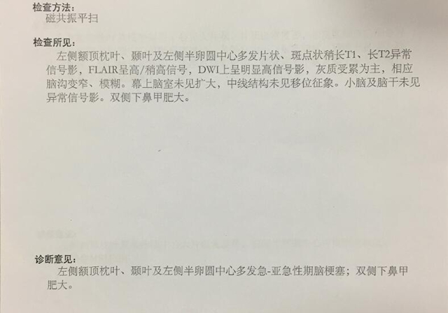 30岁女子美容,因注射失误,眼睛永久失明(图4) 4.jpg
