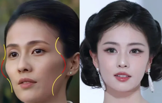 “悄悄变美”的终极秘密:拒绝肿胀馒化,用“建筑学”思维做填充(图3) 百3.jpg