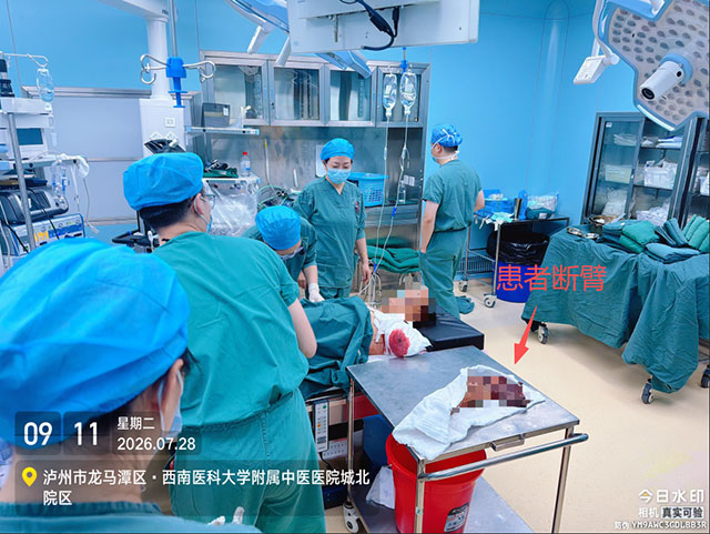 老李的胳膊被整个绞断了,提着断臂就到了......(图7) 7.jpg