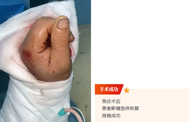 老李的胳膊被整个绞断了,提着断臂就到了......(图8) 8.jpg