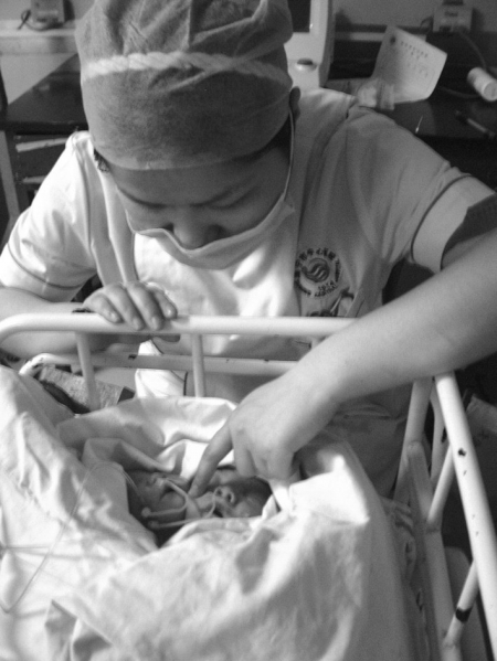 遂宁：国内首例“双头婴儿”降生(图2)