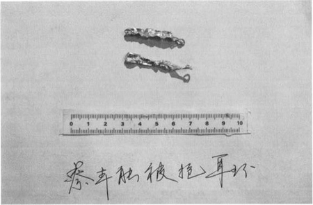 隆昌一劫匪得手后遭群众围追&nbsp;无路可逃吞下金耳环