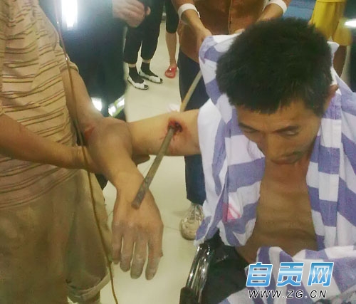 自贡男子右臂被1米多长钢筋戳穿