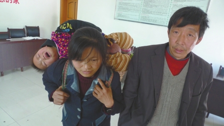 自贡富顺4岁男孩患怪病&nbsp;下身肿大如皮球(图1)