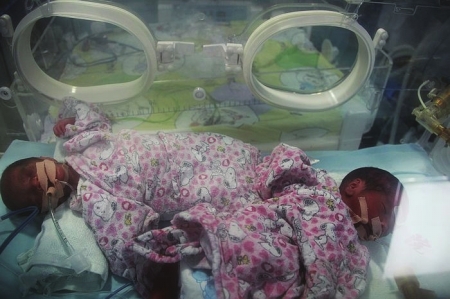 奇迹 宜宾42岁高龄产妇生下五胞胎(图2) 奇迹 宜宾42岁高龄产妇生下五胞胎(图2)