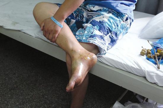 罐车刹车失灵侧翻 24吨浓硫酸泄漏(图2) 罐车刹车失灵侧翻 24吨浓硫酸泄漏(图2)