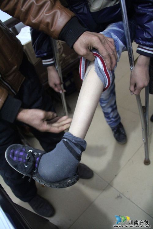 不放弃不抛弃&nbsp;泸州13岁"纸尿裤娃"和他的一家(图3)