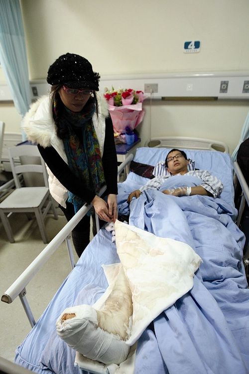 江安最美残疾教师巨型肿瘤“脱身”(图1)