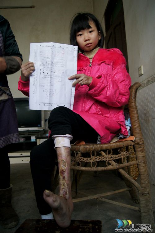 泸州叙永:情系患病少女曹雨 爱心如潮在涌动(图3) 泸州叙永:情系患病少女曹雨 爱心如潮在涌动(图3)