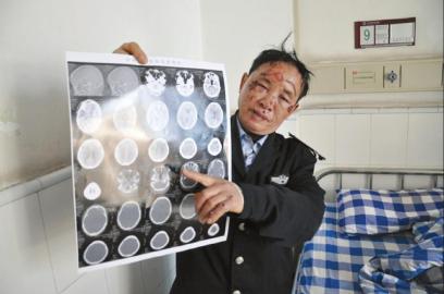 拒付5元停车费司机开车撞倒收费员