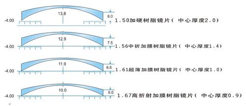 宜宾:一副眼镜100万 眼镜行业为何如此暴利?(图4) 宜宾:一副眼镜100万 眼镜行业为何如此暴利?(图4)