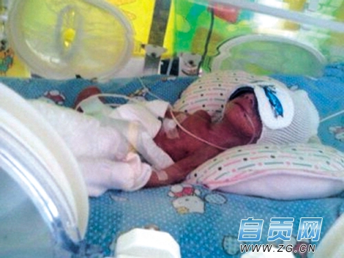 自贡一37岁孕妇产下一袖珍男婴&nbsp;比兔子还小(图1)