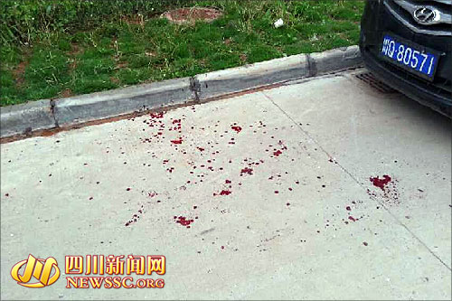 宜宾一民警抓捕嫌犯时身中3刀&nbsp;经抢救已无生命危险(图1)