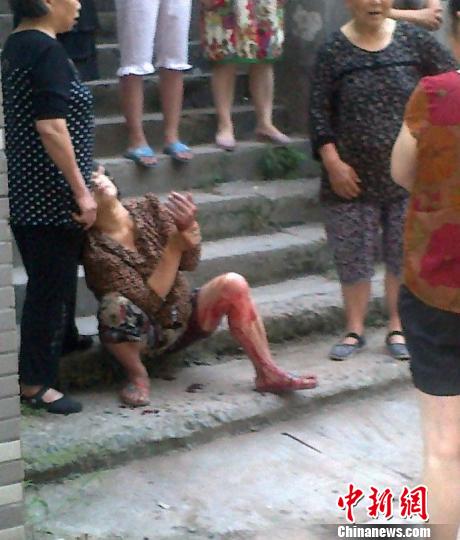 被咬伤的市民 大成网友供图 摄