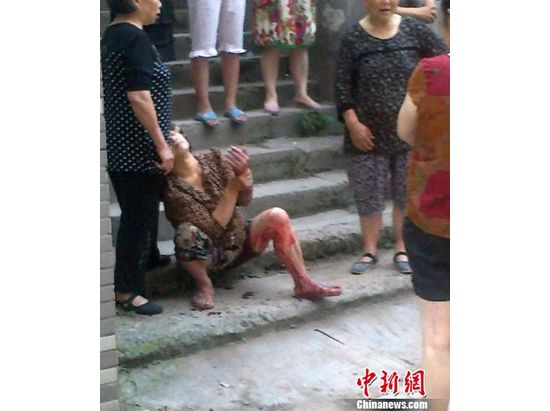 泸州流浪藏獒咬伤市民&nbsp;警方开枪击毙(图)