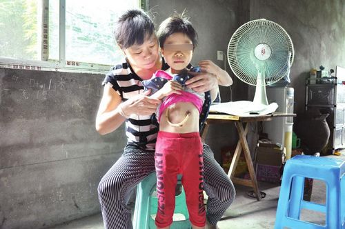 癌症妈妈：离世前想看女儿用嘴吃饭(图2)