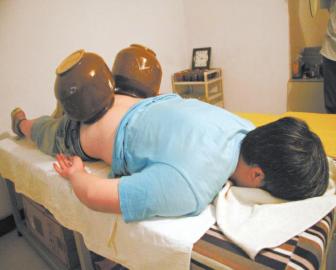 "酸菜坛子"拔火罐?谁见过这么大的火罐(图1)