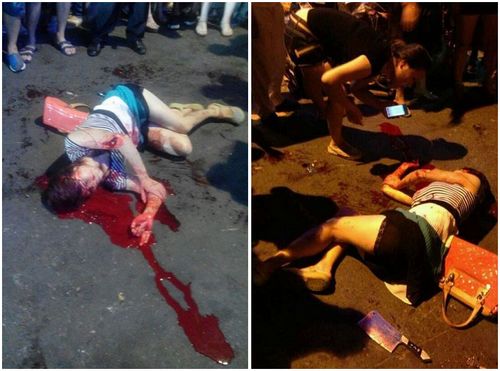 泸州女子夜市被砍伤&nbsp;疑为感情纠葛所致（图）