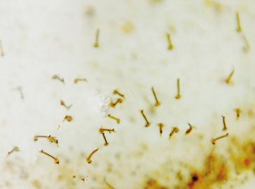 网友晒满腿大包照叹今秋蚊子狠毒&nbsp;专家支招防范(图1)