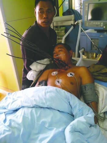 好险!7根钢筋"封喉" 奇迹!6小时拉回生命(图1) 好险!7根钢筋"封喉" 奇迹!6小时拉回生命(图1)