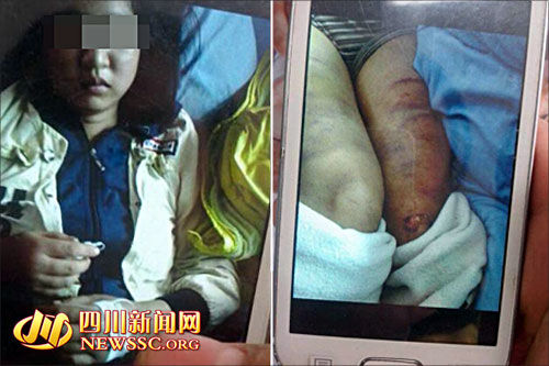 女子疑遭公公虐待下身灌水&nbsp;警方称部分失实(图1)