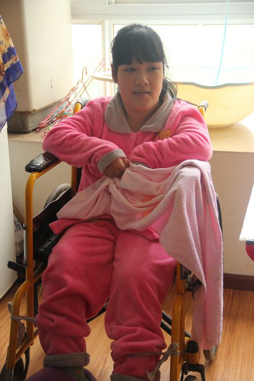 自贡脑瘫妈妈冒死剖宫产女(图4)