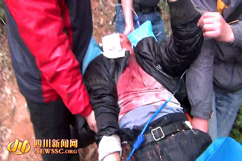 宜宾男子枪击钓鱼者头部&nbsp;向警察泼硫酸拒捕(图7)