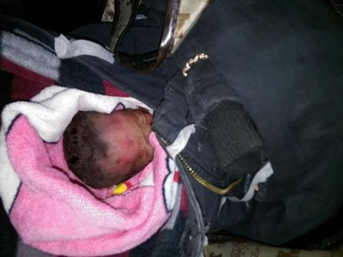 新年第一天&nbsp;宜宾早产双胞胎女婴被弃垃圾桶(图2)