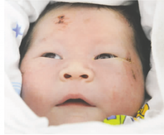 泸州男子与孕妻遇车祸身亡 胎儿被撞出生还(图1) 泸州男子与孕妻遇车祸身亡 胎儿被撞出生还(图1)