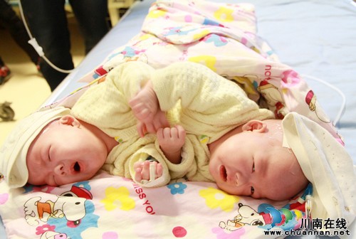 泸医附院第4例连体婴儿术后康复顺利(图3)