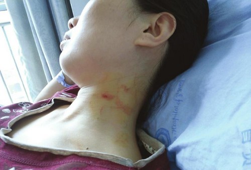 自贡：疑因为患儿拔针流血&nbsp;家属掐护士脖子(图2)