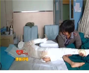 火灾无情人有情 农家男孩严重烧伤亟待救治(图2) 火灾无情人有情 农家男孩严重烧伤亟待救治(图2)