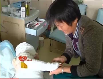 火灾无情人有情 农家男孩严重烧伤亟待救治(图5) 火灾无情人有情 农家男孩严重烧伤亟待救治(图5)