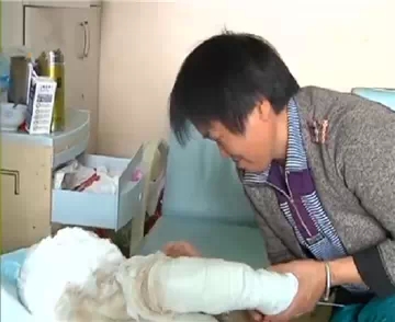 火灾无情人有情 农家男孩严重烧伤亟待救治(图4) 火灾无情人有情 农家男孩严重烧伤亟待救治(图4)