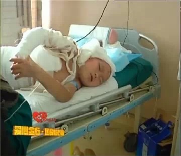 火灾无情人有情 农家男孩严重烧伤亟待救治(图1) 火灾无情人有情 农家男孩严重烧伤亟待救治(图1)