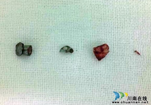 泸州:七旬大爷弯腰锄草突然中枪 开枪者成谜(图2) 泸州:七旬大爷弯腰锄草突然中枪 开枪者成谜(图2)