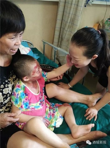 泸州弥陀8岁智残女童重度烧伤&nbsp;抚着记者脸说：我不怕(图5)