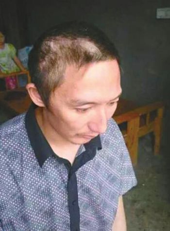 宜宾一建筑工头骨遭飞砖击碎 6户业主均遭起诉(图1) 宜宾一建筑工头骨遭飞砖击碎 6户业主均遭起诉(图1)