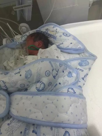 泸州:6个月早产儿生下来仅3斤&nbsp;可怜宝宝需要帮助(图1)