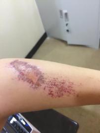 到越南旅游遇“飞车党” 自贡女游客被当街拖行(图2) 到越南旅游遇“飞车党” 自贡女游客被当街拖行(图2)